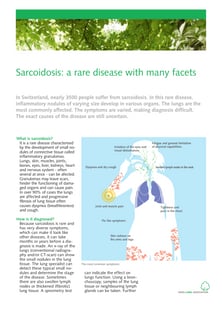 sarcoidosis-information-sheet.pdf