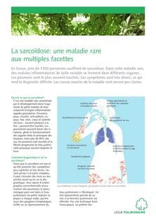 feuille-d-information-sarcoidose-.pdf